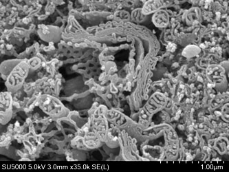 二次電子像：5 kV