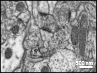 2 kV BSE image (thin section)